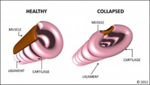 Health Issues Concerning Pomeranians